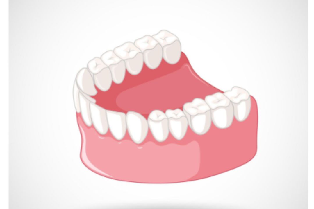 affordable full mouth teeth implants in mumbai